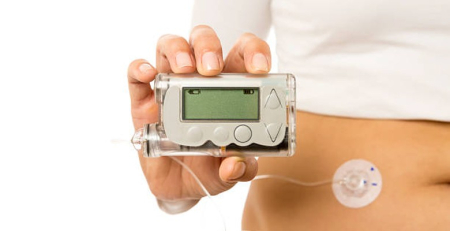 Acesso a bombas de insulina para o tratamento da diabetes tipo 1 triplicou desde 2015